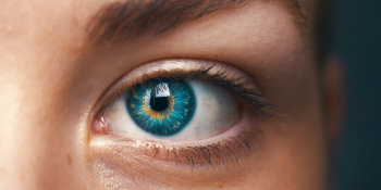 Human eye, blue with yellow discolouration and black iris