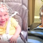 Babies wearing 'head cap' to measure electrical brain activity