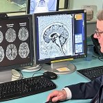 Patrick Chinnery looks at brain scans on a computer screen