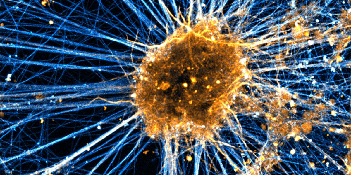A neuron made from stem cell 
